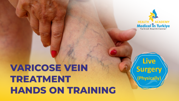 Varicose Vein Treatment Live Surgery Course